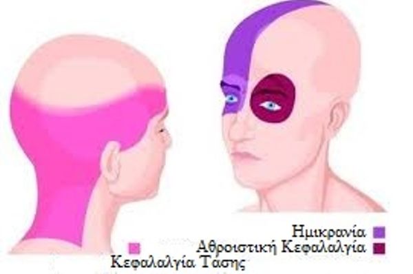 Κεφαλαλγία Τάσης
