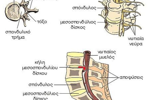  Πότε πρέπει να κάνω Μαγνητική Τομογραφία για τον πόνο στη μέση μου;