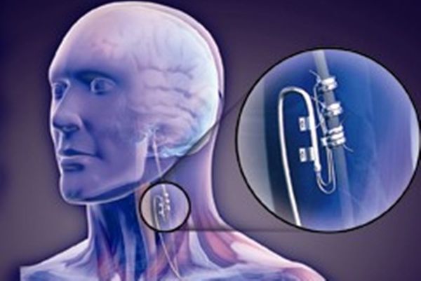Νέα Μελέτη για τη Θεραπεία της Ανθεκτικής Ινομυαλγίας