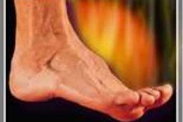 Επώδυνη Διαβητική Πολυνευροπάθεια
