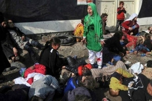  Πήρε Pulitzer για μια αιματοβαμμένη φωτογραφία 