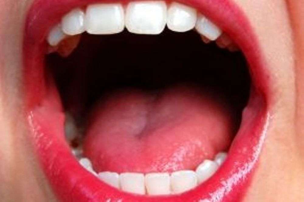 Καρκίνος του στόματος
