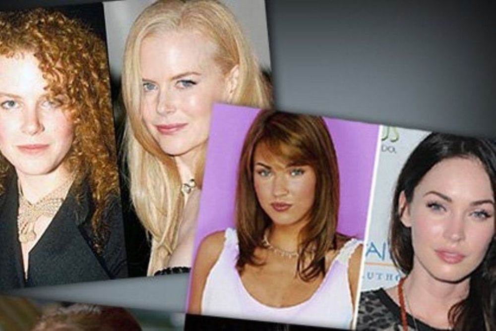 Stars και πλαστικές: Ποιοι παραμορφώθηκαν;