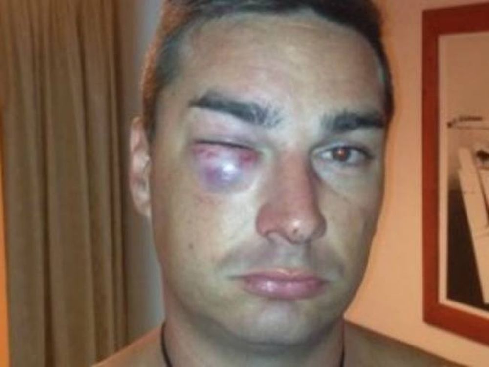 Τουρίστας καταγγέλει Αστυνομικούς για ξυλοδαρμό!