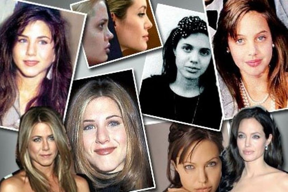 Angelina Jolie- Jennifer Aniston: ποια έχει κάνει τις περισσότερες πλαστικές επεμβάσεις;