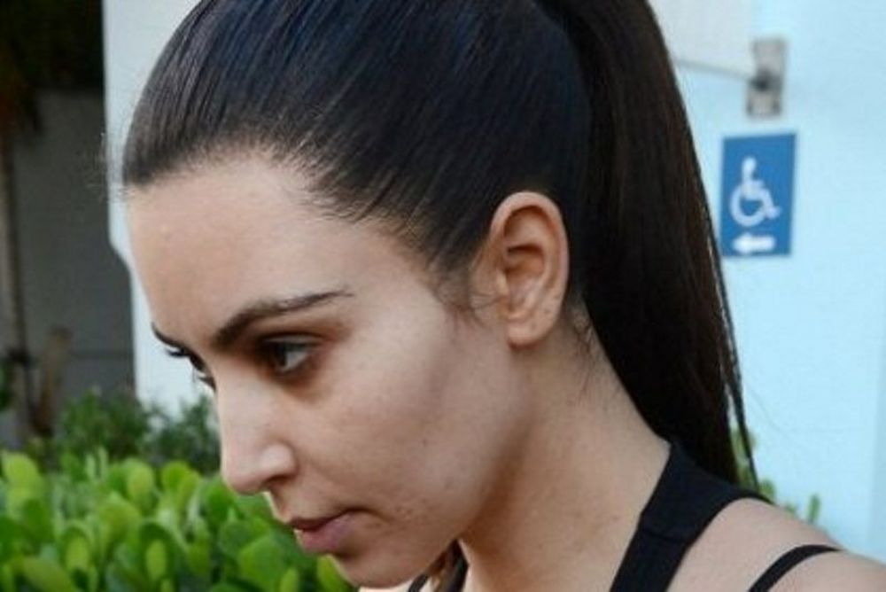 Τί συμβαίνει με το δέρμα της Kim Kardashian;