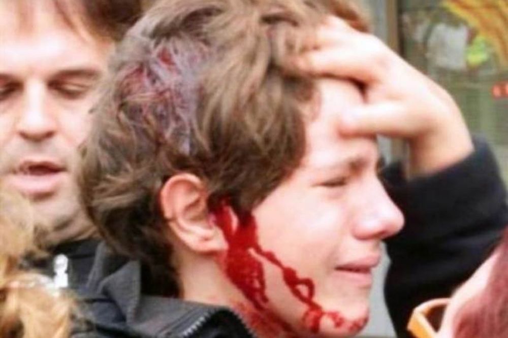 Βίντεο - ΣΟK: Αστυνομικοί χτύπησαν 13χρονο διαδηλωτή 