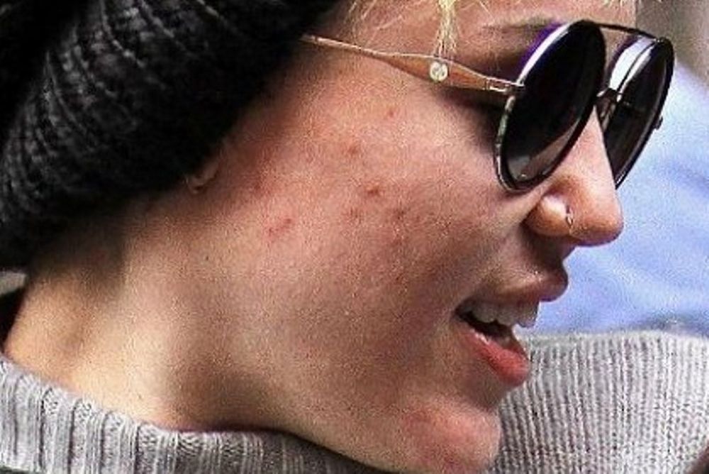 Η Miley Cyrus δεν είναι τόσο τέλεια όσο πιστεύαμε!