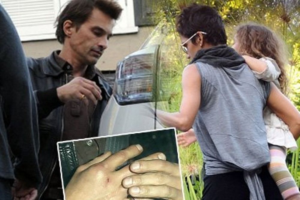 Πρώην και νυν της Halle Berry «πιάστηκαν στα χέρια» και κατέληξαν στο νοσοκομείο!
