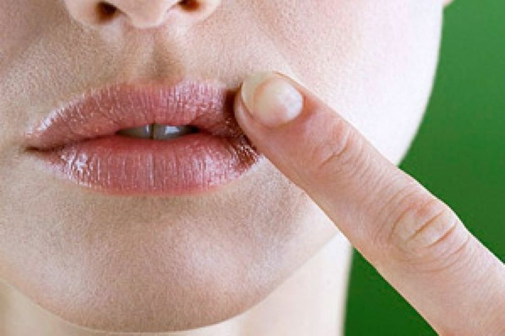 Πώς να αποφύγετε τον επιχείλιο έρπητα