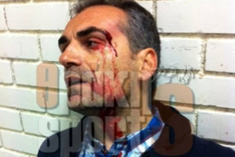 Μαυρομάτης: «Δεν μπορούσα να το φανταστώ»