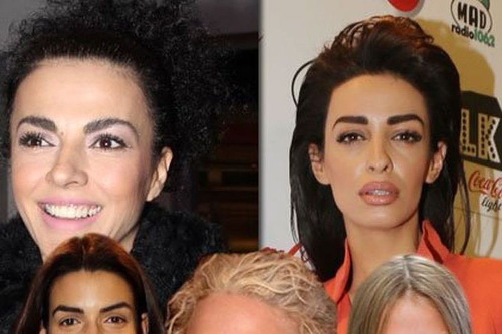 Τι συμβαίνει με τα φρύδια της showbiz; 
