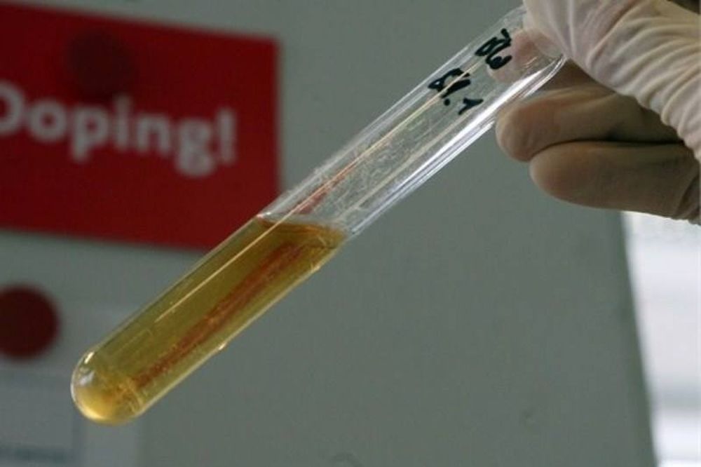Παγκόσμιο Κύπελλο 2014: «Καθαροί» οι ποδοσφαιριστές