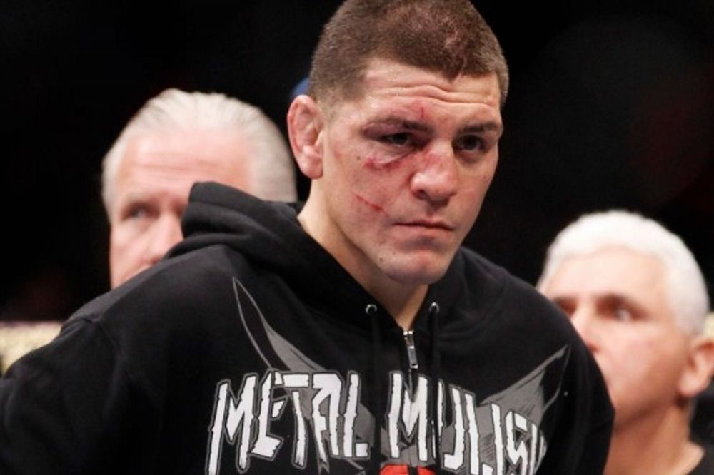 UFC 183: Στον… αέρα ο Nick Diaz