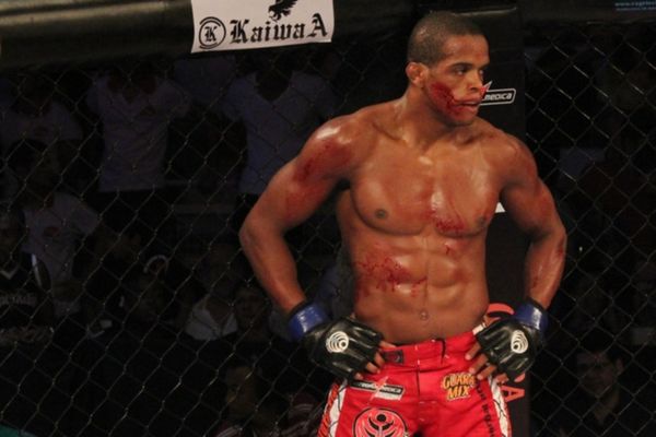 UFC 179: Ανατριχιαστικός τραυματισμός του Alan Patrick