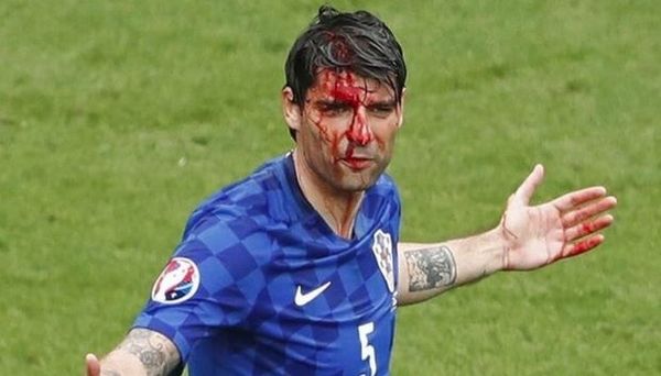 Euro 2016: Σοκαριστικός τραυματισμός για Τσόρλουκα! (videos)