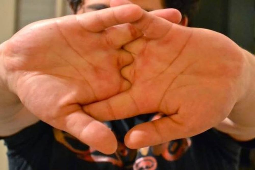 Δείτε πώς το μήκος των δακτύλων μπορεί να σου αποκαλύψει μέχρι και το μέγεθος του πέους (photos)