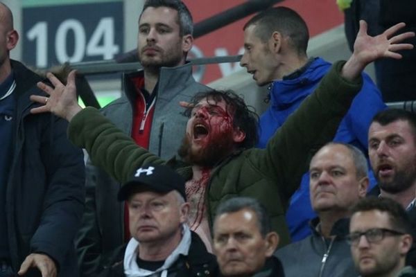 Ξύλο ανάμεσα σε οπαδούς Αγγλία και Σκωτίας (Pics)