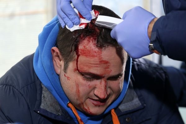 Σοκαριστικά video από τα άγρια επεισόδια στο Ηρακλής-ΠΑΣ Γιάννινα!