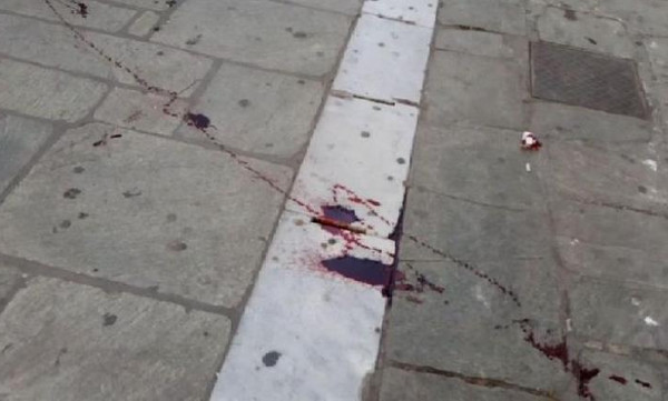 ΠΑΟΚ-ΑΕΚ: Αιματηρή συμπλοκή οπαδών στο Βόλο (σοκαριστικές εικόνες)