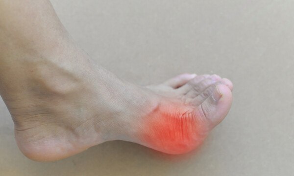 Υψηλό ουρικό οξύ: Πώς θα προλάβετε τα επεισόδια ουρικής αρθρίτιδας (εικόνες)