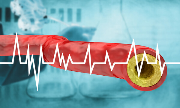 Εξέταση χοληστερίνης: Επιτρέπεται να φάω κανονικά την προηγούμενη μέρα;