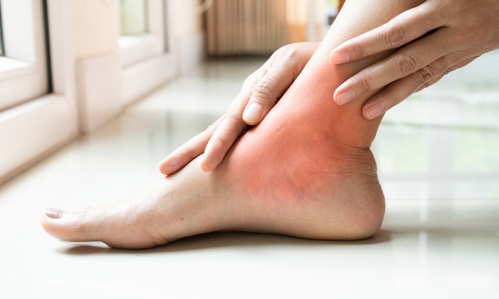 Πρησμένοι αστράγαλοι: 9 πιθανές αιτίες (εικόνες)