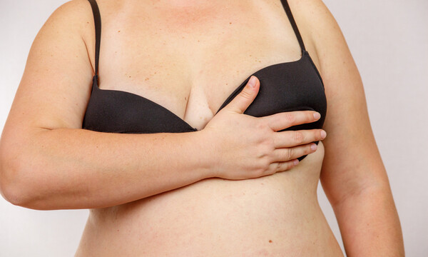 13 μορφές καρκίνου που συνδέονται με τα περιττά κιλά (εικόνες)