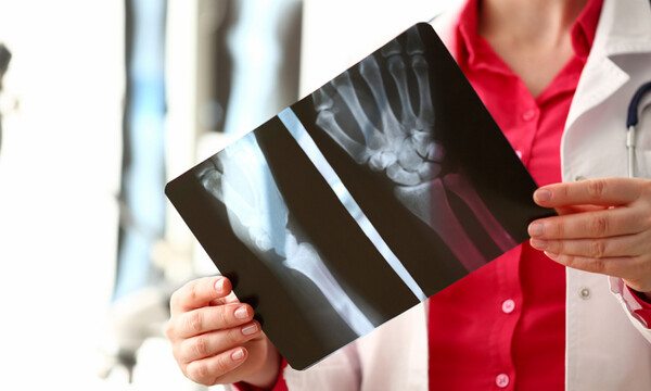 Καρκίνος στα οστά: Κοινά και σπάνια συμπτώματα (εικόνες)