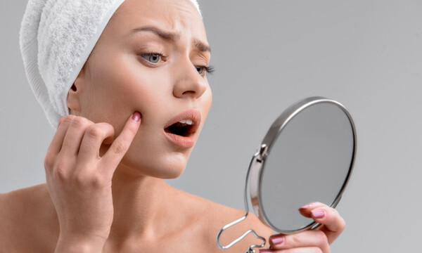 Επτά λόγοι που εμφανίζονται σπυράκια στο πρόσωπο (εικόνες)