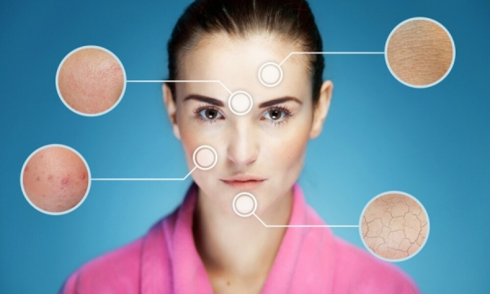 Δερματικά προβλήματα: Αναγνωρίστε τα μέσα από φωτογραφίες