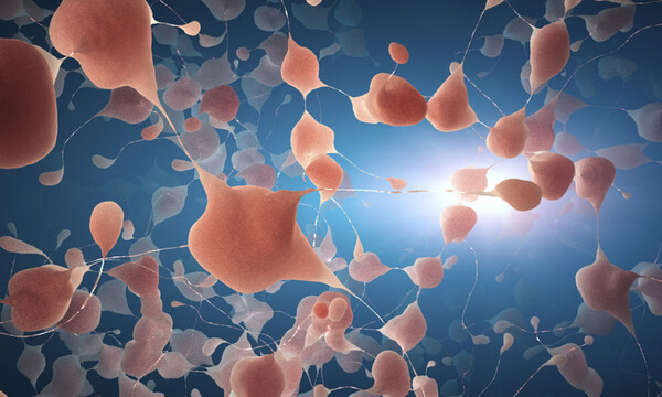 Σκλήρυνση κατά πλάκας: 8 χαρακτηριστικές ενδείξεις (εικόνες)