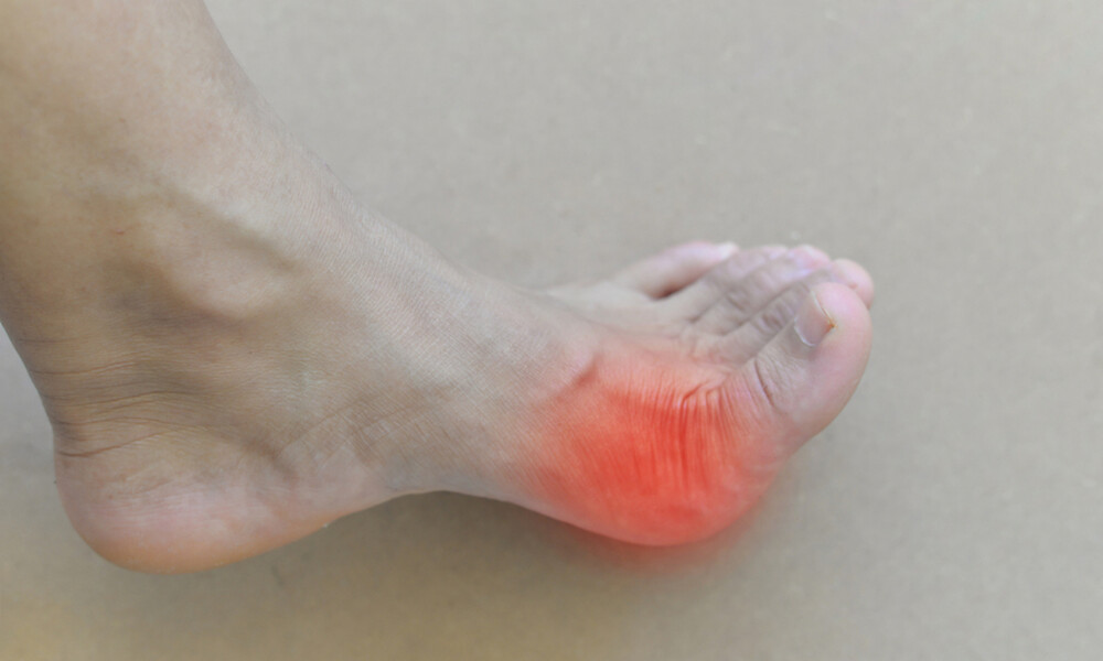 Κρίση ουρικής αρθρίτιδας: Πώς θα την αντιμετωπίσετε (video)