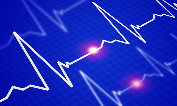 Έμφραγμα: Ποια προειδοποιητικά σημάδια είναι συχνότερα στους άνδρες & ποια στις γυναίκες (εικόνες)