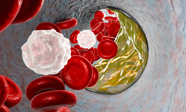 Καλή και κακή χοληστερόλη: Πώς επηρεάζουν τη γονιμότητα