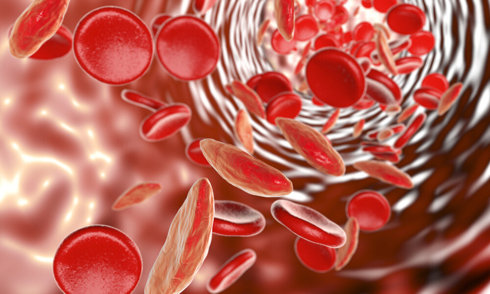 Αναιμία: 6 φρούτα που ενισχύουν την παραγωγή αιμοσφαιρίνης (φωτο)