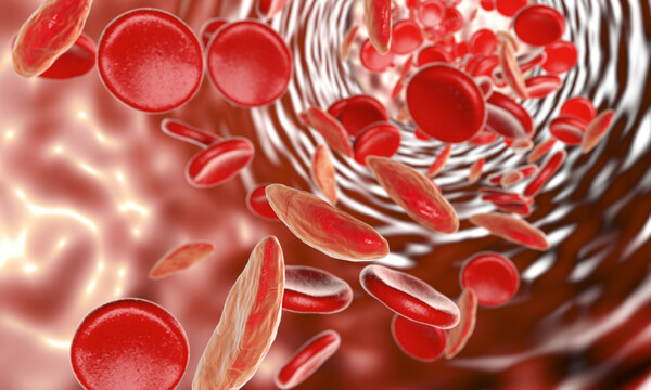 Αναιμία: 6 φρούτα που ενισχύουν την παραγωγή αιμοσφαιρίνης (φωτο)