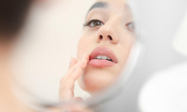 Άφθα ή επιχείλιος έρπης; Ξεχωρίστε τα μέσα από φωτογραφίες