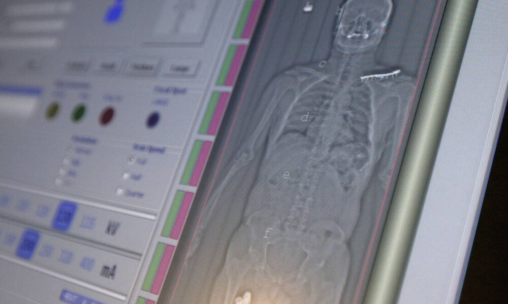 Κορονοϊός: Δείτε τι κάνει στο ανθρώπινο σώμα - Ποια όργανα επηρεάζει