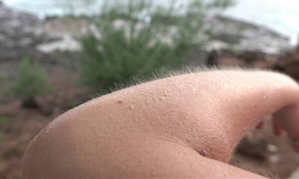 Γιατί σηκώνονται οι τρίχες όταν ανατριχιάζουμε; (video)