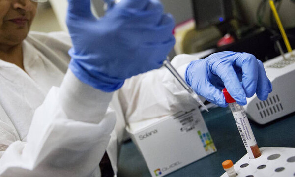 Κορονοϊός: Ανακάλυψη που θα μπορούσε να συνεισφέρει στον περιορισμό των θανάτων