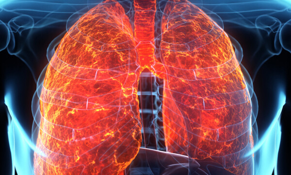 Υγρό στους πνεύμονες: Τα ανησυχητικά συμπτώματα (εικόνες)