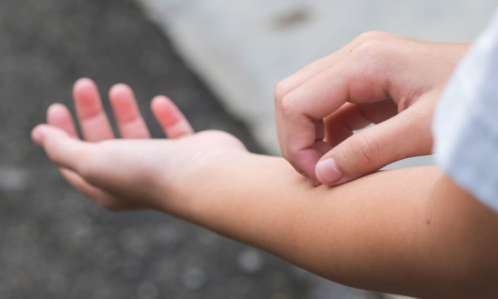 Φαγούρα στο δέρμα: 11 πράγματα που αποκαλύπτει για την υγεία (εικόνες)