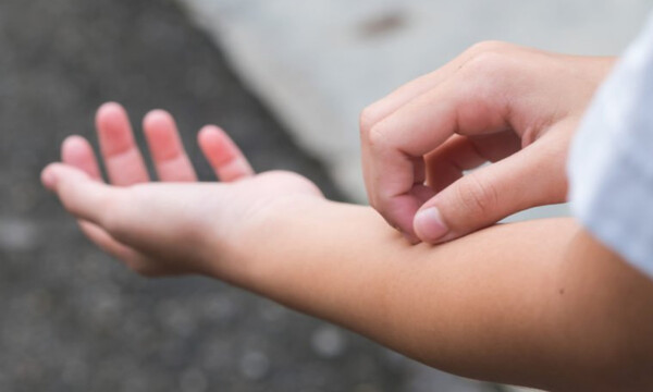 Φαγούρα στο δέρμα: 11 πράγματα που αποκαλύπτει για την υγεία (εικόνες)