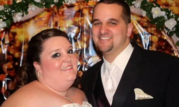 Νύφη έμεινε μισή μετά το γάμο. Η εικόνα με το νυφικό της σοκάρει, χρόνια μετά... (photos)