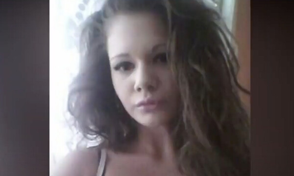 Ήθελε να αποκτήσει τα μεγαλύτερα χείλη του κόσμου - Το αποτέλεσμα είναι τρομακτικό (photos)