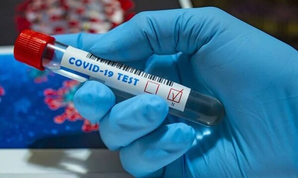 Γνωστό μοντέλο νίκησε τον κορονοϊό έπειτα από 74 ημέρες: Ήταν δύο μήνες «κόλαση» (pics)