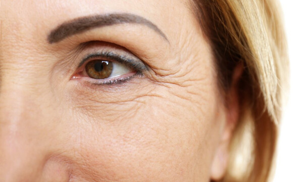 Ανεπάρκεια βιταμινών: Με ποια σημάδια εκδηλώνεται στο πρόσωπο (εικόνες)