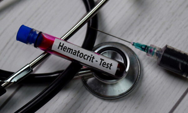 Χαμηλός αιματοκρίτης: Πού μπορεί να οφείλεται (εικόνες)
