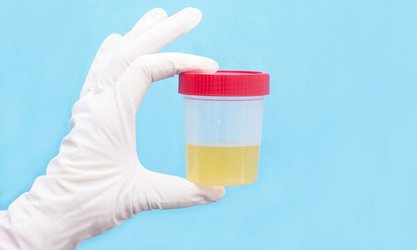 Ούρα: 5 πράγματα που φανερώνουν για την υγεία (εικόνες)